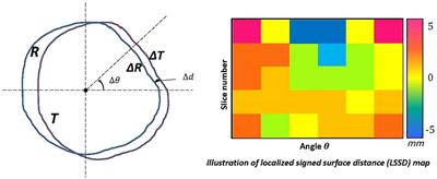 A real-time contouring feedback tool for consensus-based contour training